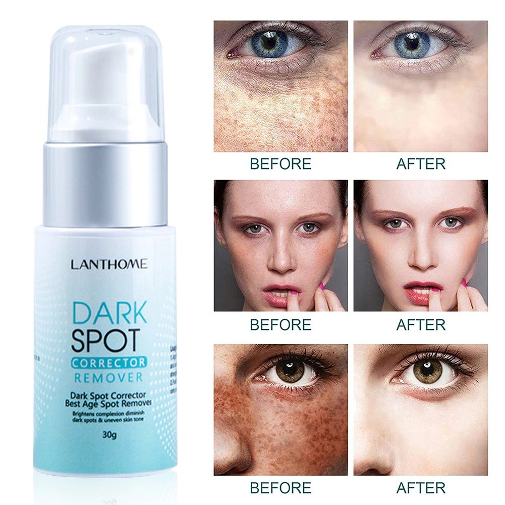 Dark Spot Corrector Remover