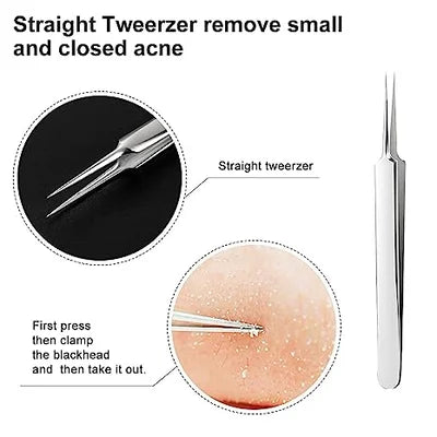 Professional Ultra-fine No.5 Acne Blackhead Removal Tweezers (Pcs 3)