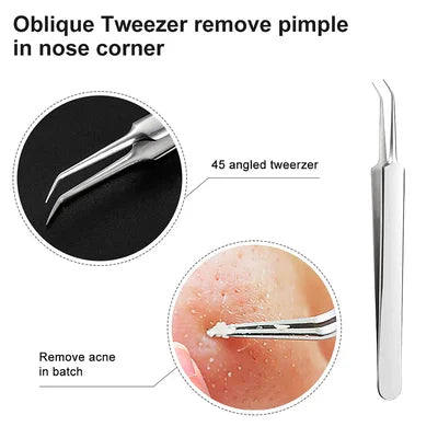 Professional Ultra-fine No.5 Acne Blackhead Removal Tweezers (Pcs 3)